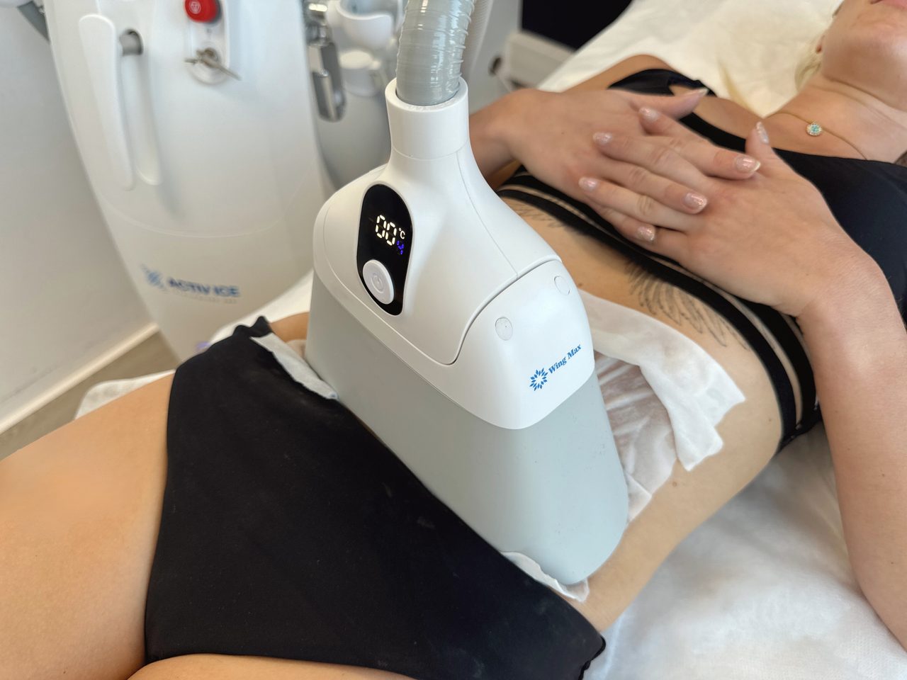 Soin cryolipolyse abdomen avec applicateur Wing Max — température affichée