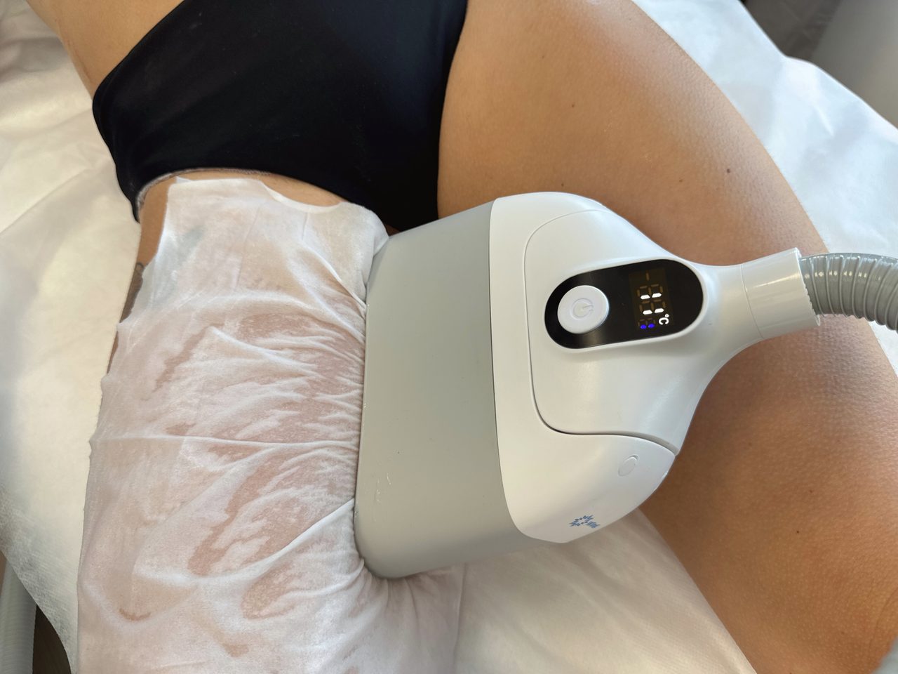 Applicateur cryolipolyse Activ Ice en soin — affichage température cuisse