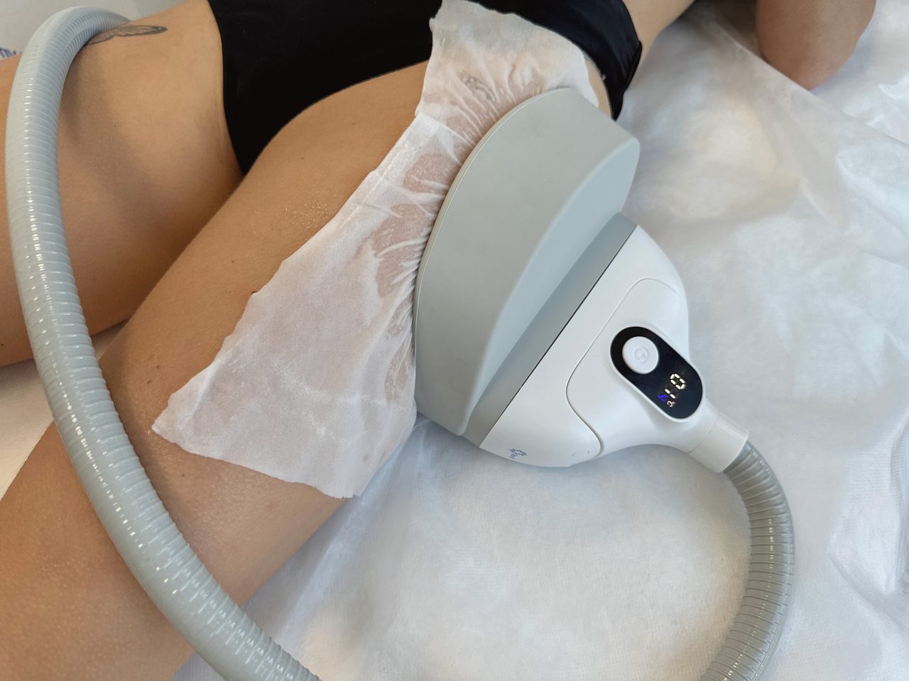 Applicateur Arc-T cryolipolyse cuisses Activ Ice en soin