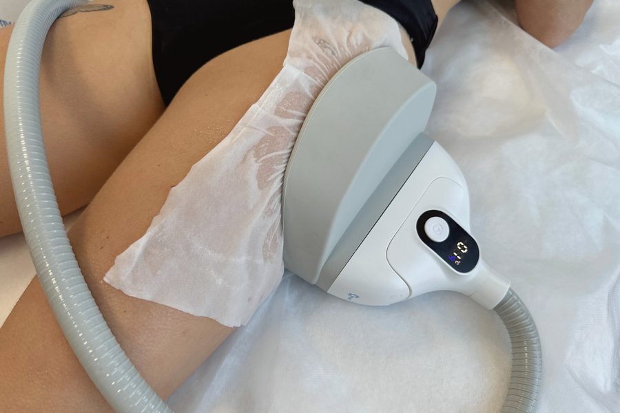 Soin cryolipolyse cuisses avec applicateur Arc-T Activ Ice