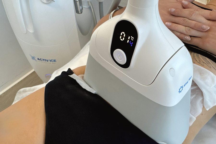 Cryolipolyse cuisses en cours — applicateur positionné sur cuisse